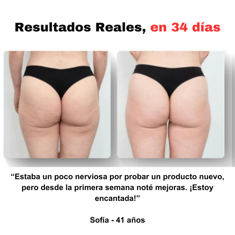 CelluStop™ – Masajeador Anticelulitis